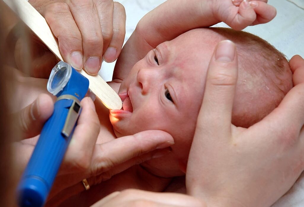 Strep Throat and Newborns – 7 Critical Parent Tips You Must Know!