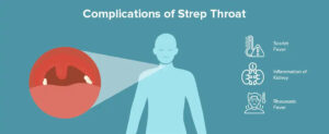 Common Mistakes About Strep Throat Contagious Period: