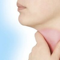 7 Shocking Facts About Is the Strep Throat Contagious You Must Know!