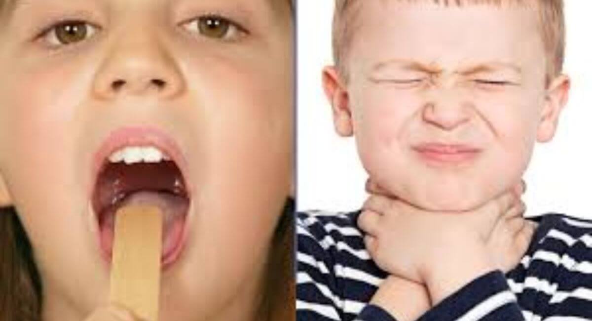 Strep Throat Without Tonsils: 10 Critical Things You Must Know!