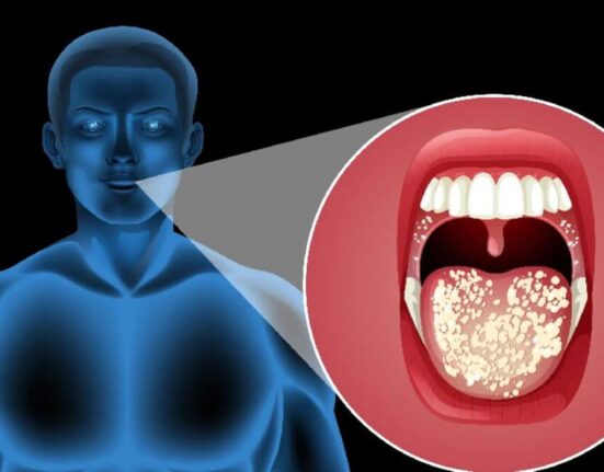 Tonsillitis vs Strep Throat: 10 Critical Differences You Must Know!