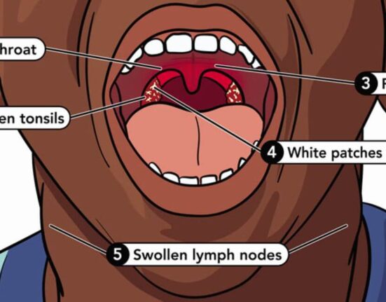 Untreated Strep Throat - 7 Proven Facts That Save Lives!