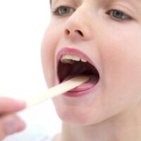How Long Does a Strep Throat Last Without Antibiotics - 7 Brutal Truths!