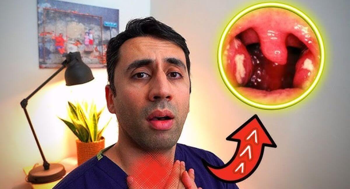 Tonsillitis Strep Throat - 7 Brutal Truths Doctors Never Share!