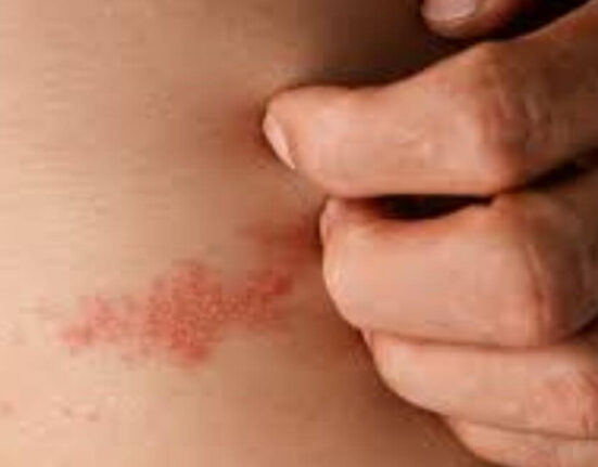Can Strep Throat Cause Skin Rash - 7 Warning Signs You Should Never Ignore!