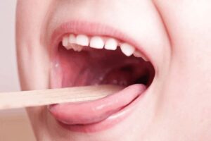 Common Misconceptions About Getting Strep After Tonsil Removal: