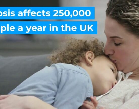 Is Sepsis Contagious - 7 Shocking Facts Nobody Ever Tells You!