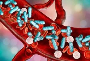 Common Infections That Cause Sepsis and Their Actual Transmissibility:
