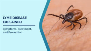 Symptoms of Lyme Disease When Bacteria Travel: