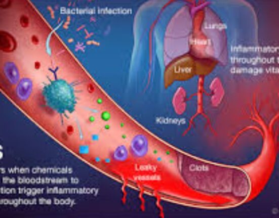 Sepsis in Spanish - 7 Shocking Realities!