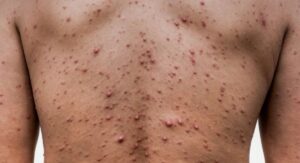 Recognising Viral Infection Symptoms Across Your Whole Body: