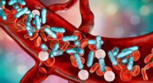 Warning Signs of Sepsis in Spanish Patients: