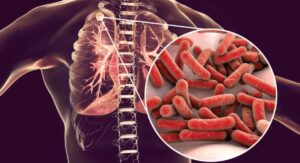 What Bacteremia Really Is — Starting From Zero: