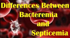 How Doctors Actually Tell Bacteremia vs Sepsis Apart: