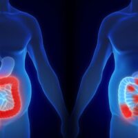 Colon Cancer Surgery - 7 Honest Facts!