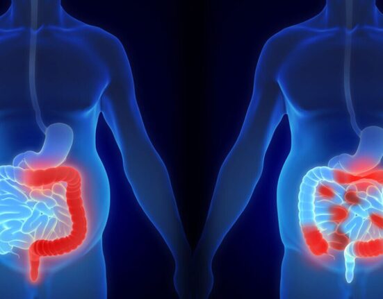 Colon Cancer Surgery - 7 Honest Facts!