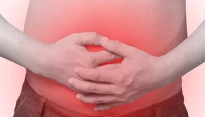 Colon Cancer Surgery and the Stoma Question: