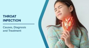 Does Strep Throat Cause Cough When Complications Develop