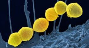 What Causes Strep Throat at the Biological Level