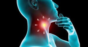 What Is Strep Throat and What Causes It