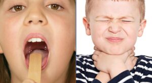 Strep in Children During the Contagious Stage