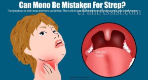 Mono Throat vs Strep Throat Systemic Symptoms That Differ Significantly: